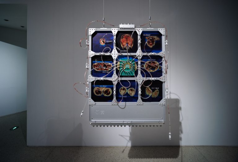 Circular Interface: Anatomy